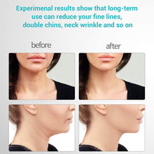 Load image into Gallery viewer, Fabhera™ - Skin Rejuvenating Device