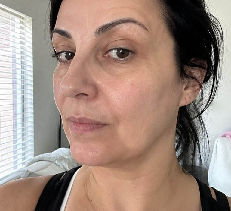 Before Treatment Condition