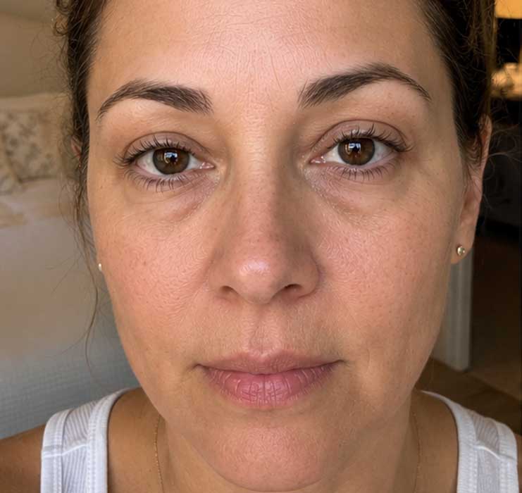 Before Treatment Condition