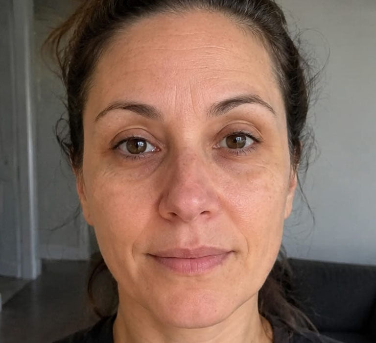 Before Treatment Condition