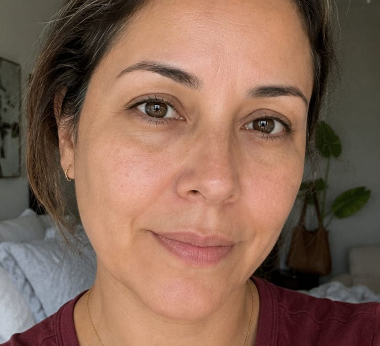 After Treatment Result